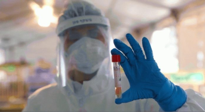 nucleic-acid-test
