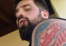 СРБИН ПРЕТУЧЕН ЗБОГ KРСТА И ГРБА! Нашег човека БРУТАЛНО пребила три нападача близу Сплита! (ФОТО)