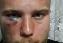 ЗВЕРСКИ ПРЕТУЧЕН СРБИН У ЦРНОЈ ГОРИ! Уз псовање „српске мајке“, Петра тукли Един, Алдин, Хивза, Белмин и Асмир! (ФОТО)
